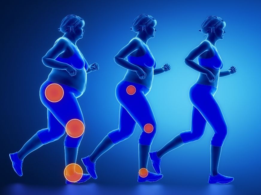 leto-bez-celulitidy-zbavte-sa-jej-stravou-a-tymito-procedurami-3 - Gyors fogyás szakértői felügyelet mellett | NUTRI FOOD PLAN